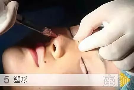 https://img.miyanlife.com/mnt/timg/180921/113IM232-8.jpg