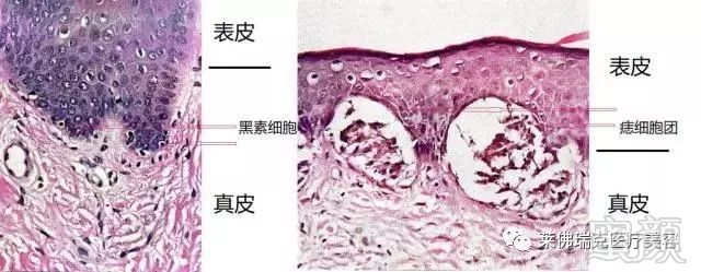 案例图片