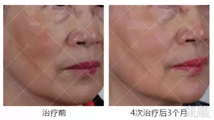 https://img.miyanlife.com/mnt/timg/180921/1244291U3-6.jpg