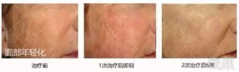 https://img.miyanlife.com/mnt/timg/180921/1244323049-9.jpg
