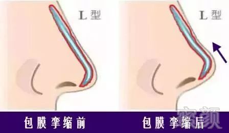 案例图片