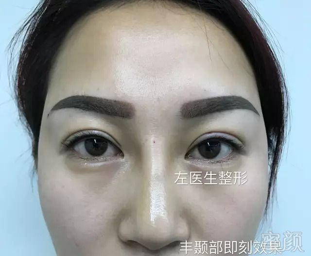 https://img.miyanlife.com/mnt/timg/180922/161K63018-4.jpg