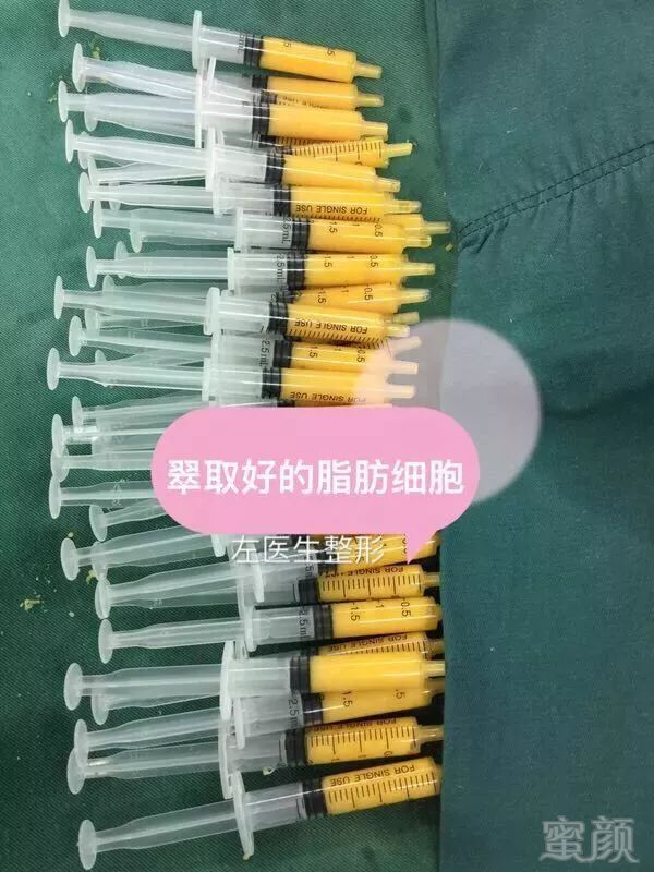 https://img.miyanlife.com/mnt/timg/180922/161K63096-5.jpg