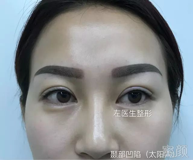 https://img.miyanlife.com/mnt/timg/180922/161KB524-3.jpg