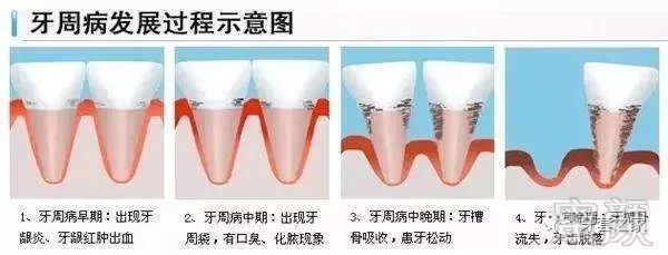 案例图片