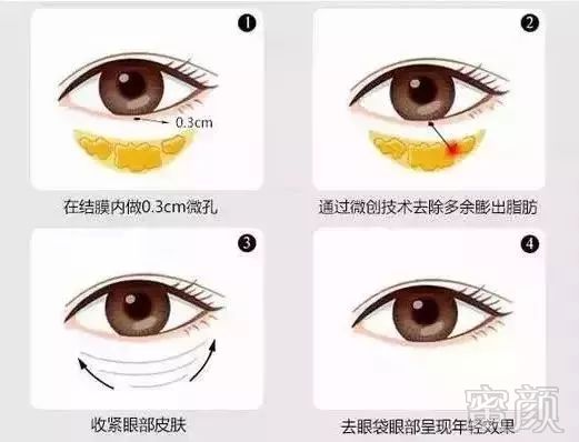 https://img.miyanlife.com/mnt/timg/180923/1202023430-3.jpg