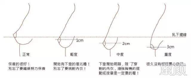 案例图片