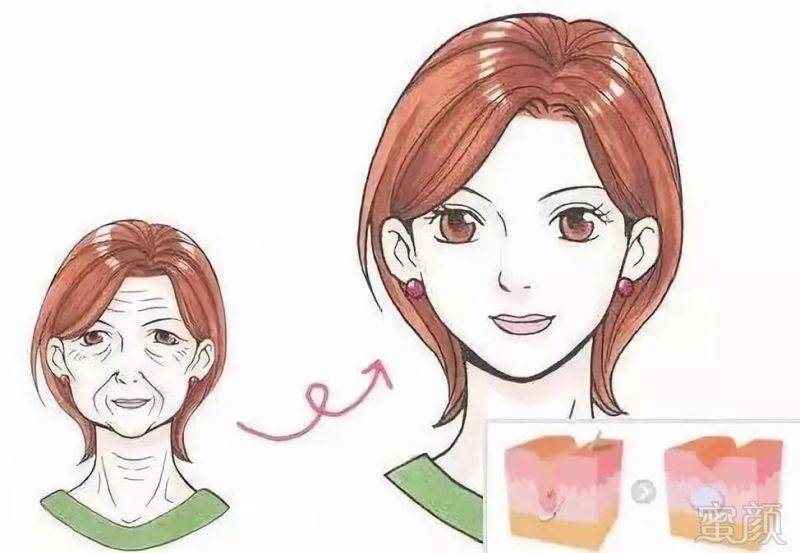 https://img.miyanlife.com/mnt/timg/180924/113K24B5-6.jpg