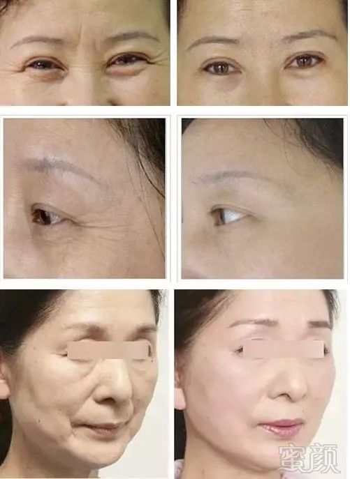 https://img.miyanlife.com/mnt/timg/180925/10512H603-9.jpg