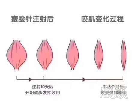 https://img.miyanlife.com/mnt/timg/180925/110J02c0-1.jpg