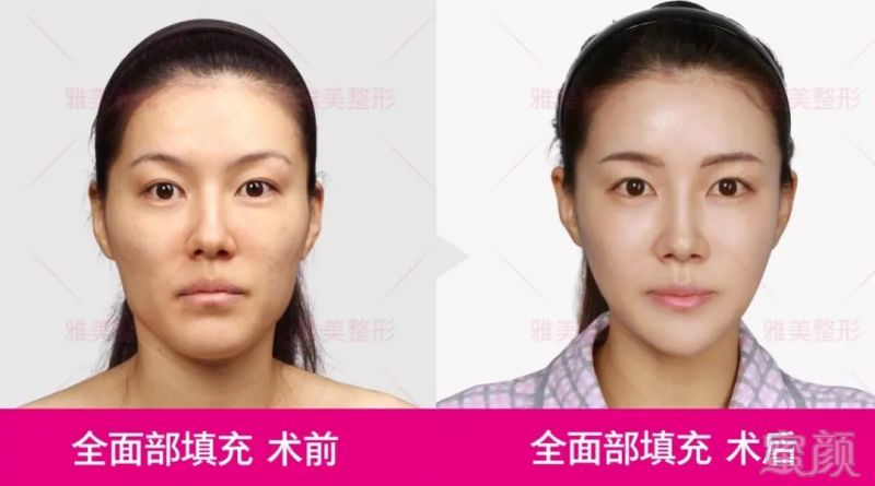 https://img.miyanlife.com/mnt/timg/180925/110R06127-6.jpg