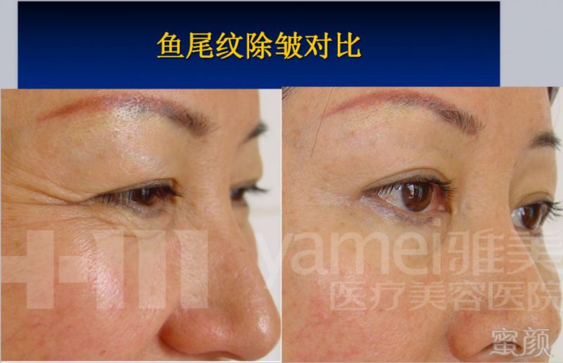 https://img.miyanlife.com/mnt/timg/180925/110R0NP-5.jpg