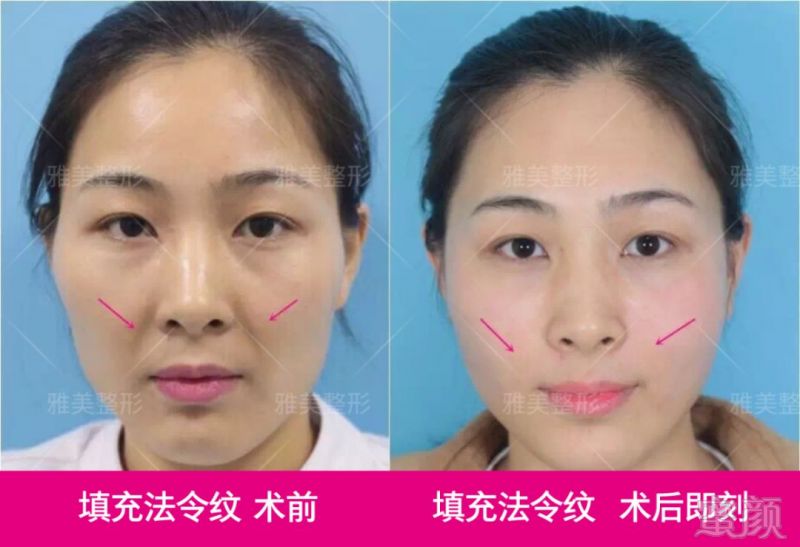 https://img.miyanlife.com/mnt/timg/180925/110R1H44-7.jpg