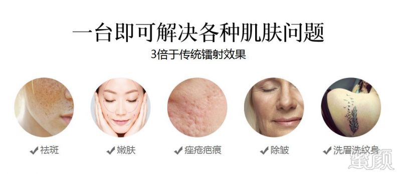 https://img.miyanlife.com/mnt/timg/180925/1142505N1-1.jpg