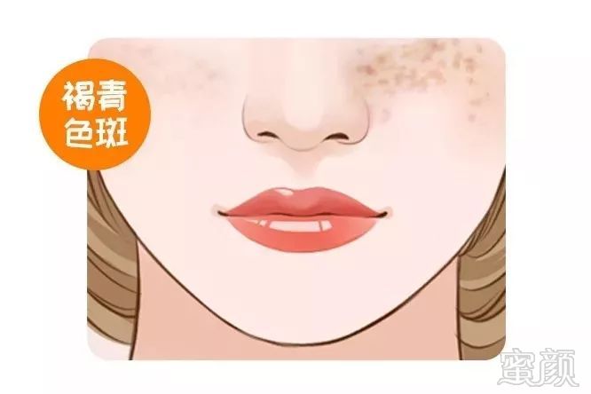 https://img.miyanlife.com/mnt/timg/180925/11452Ga6-8.jpg