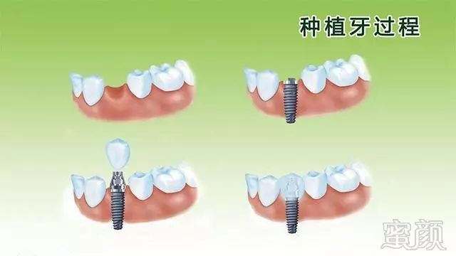 https://img.miyanlife.com/mnt/timg/180925/1152043X3-1.jpg