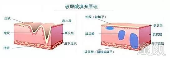 https://img.miyanlife.com/mnt/timg/180925/120P91154-5.jpg