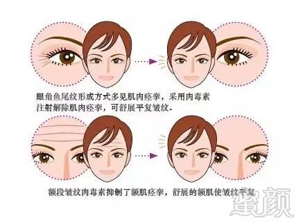 https://img.miyanlife.com/mnt/timg/180925/120P96114-10.jpg