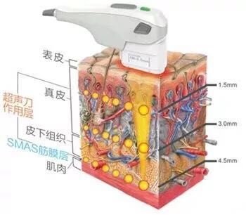 案例图片