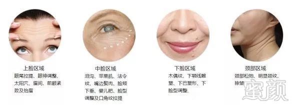 https://img.miyanlife.com/mnt/timg/180926/105A46111-3.jpg