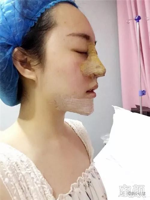 https://img.miyanlife.com/mnt/timg/180926/1133164G5-2.jpg