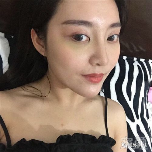 https://img.miyanlife.com/mnt/timg/180926/11331IB8-4.jpg