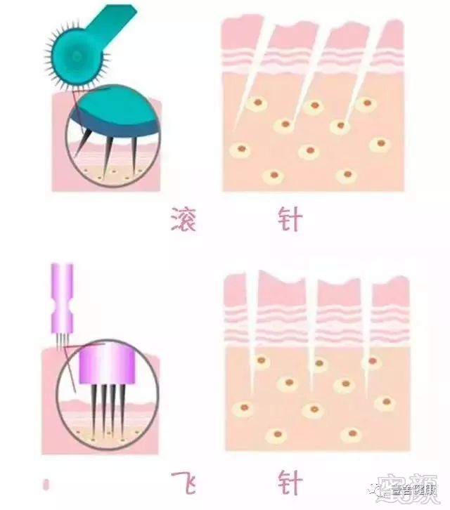 https://img.miyanlife.com/mnt/timg/180926/1140496027-7.jpg