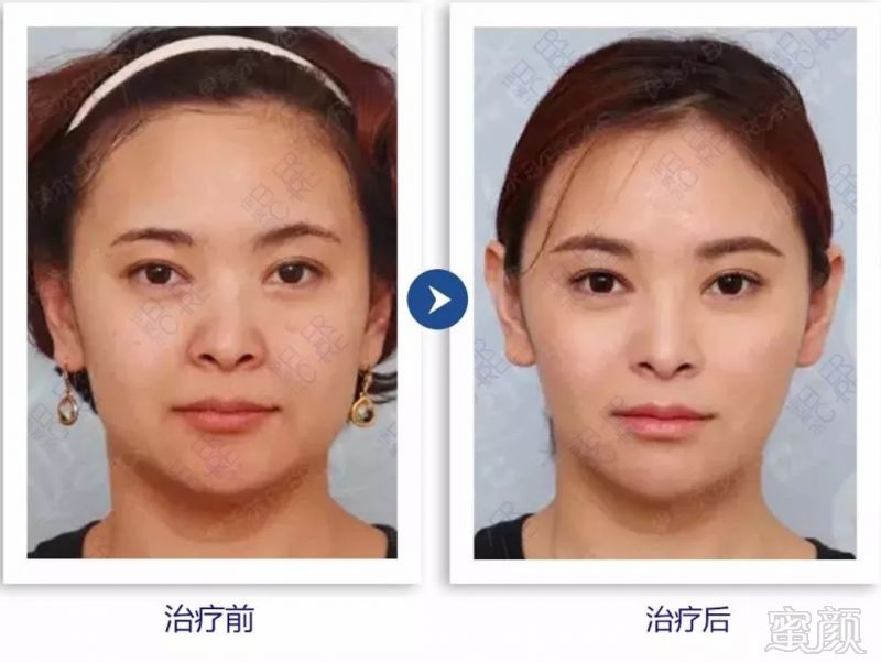 https://img.miyanlife.com/mnt/timg/180926/11454IU7-11.jpg