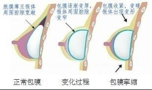 案例图片