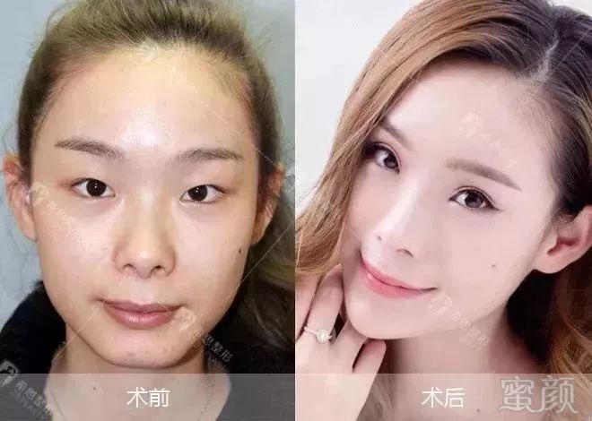 https://img.miyanlife.com/mnt/timg/180927/11061025F-7.jpg