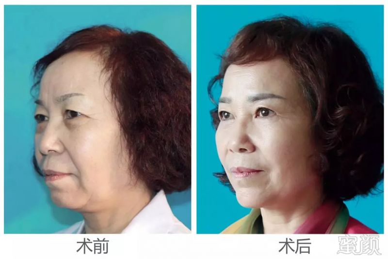 https://img.miyanlife.com/mnt/timg/180927/1143452941-2.jpg