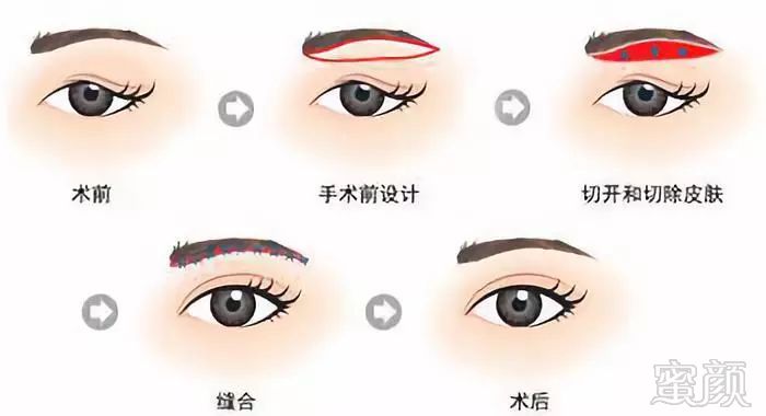 https://img.miyanlife.com/mnt/timg/180927/1143463963-3.jpg