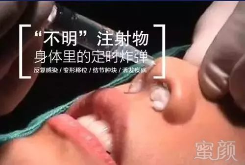 https://img.miyanlife.com/mnt/timg/180927/1156036119-0.jpg