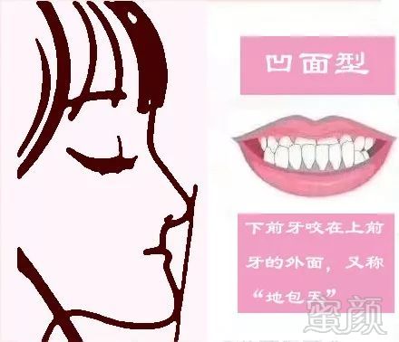 https://img.miyanlife.com/mnt/timg/180927/1202235932-3.jpg