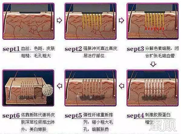 案例图片