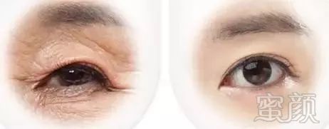 https://img.miyanlife.com/mnt/timg/180927/12123U3U-4.jpg