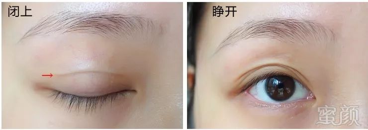 https://img.miyanlife.com/mnt/timg/180927/12123U618-6.jpg