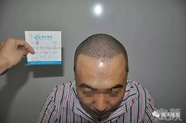 https://img.miyanlife.com/mnt/timg/180927/12131V263-5.jpg