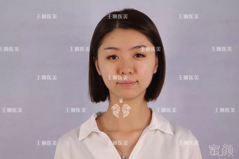 https://img.miyanlife.com/mnt/timg/180927/1224312638-7.jpg