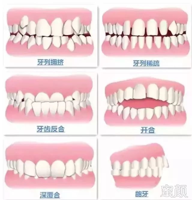 https://img.miyanlife.com/mnt/timg/180927/1230353503-2.jpg