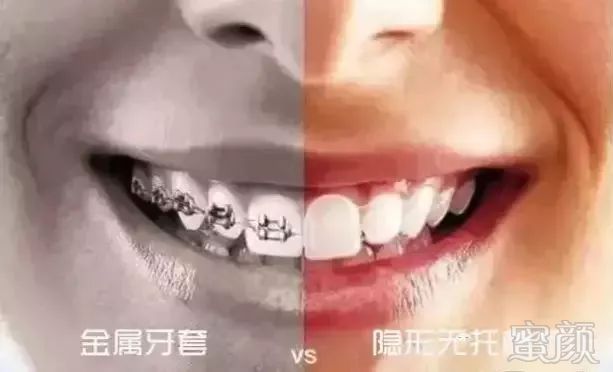 https://img.miyanlife.com/mnt/timg/180927/1230354620-3.jpg