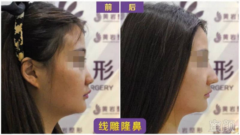 https://img.miyanlife.com/mnt/timg/180927/1233421314-4.jpg