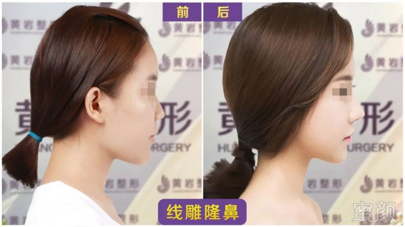 https://img.miyanlife.com/mnt/timg/180927/1233433141-7.jpg