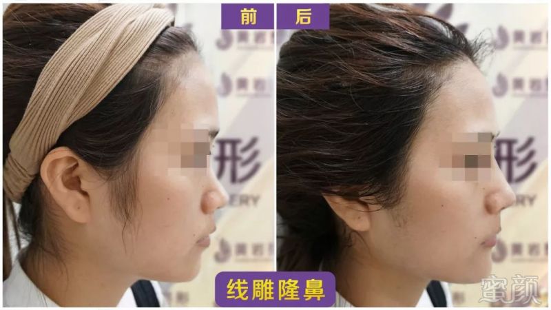 https://img.miyanlife.com/mnt/timg/180927/1233435357-6.jpg