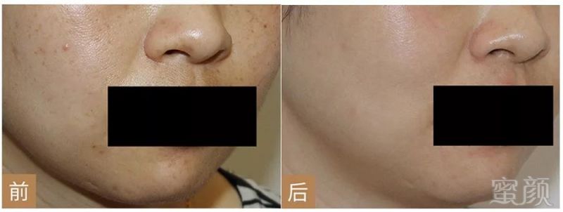 https://img.miyanlife.com/mnt/timg/180927/12511GQ3-0.jpg