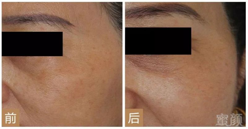 https://img.miyanlife.com/mnt/timg/180927/12511HI7-1.jpg