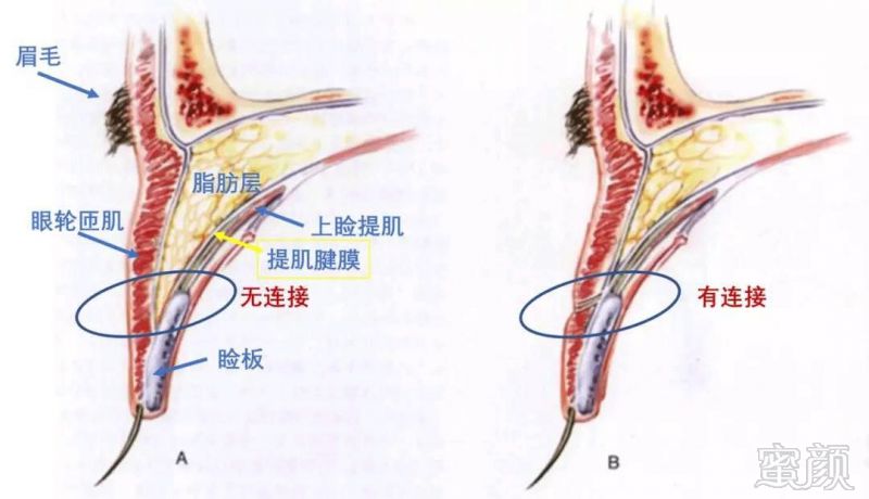 https://img.miyanlife.com/mnt/timg/180927/13210625W-0.jpg