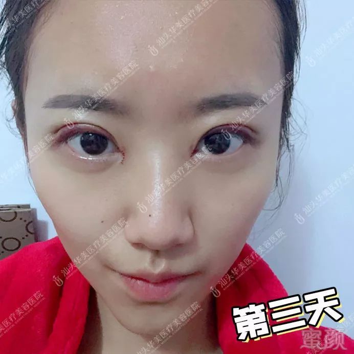 https://img.miyanlife.com/mnt/timg/180927/13210W1X-5.jpg