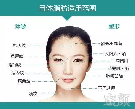 https://img.miyanlife.com/mnt/timg/180927/1332562554-3.jpg