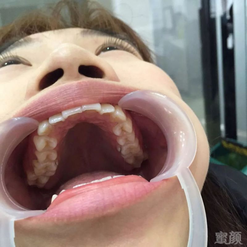 https://img.miyanlife.com/mnt/timg/180927/1342515P9-9.jpg